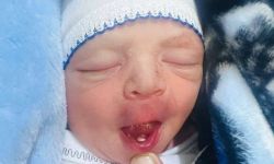 مولود جديد في العراق يفاجئ الأطباء بـ"سن لبني"